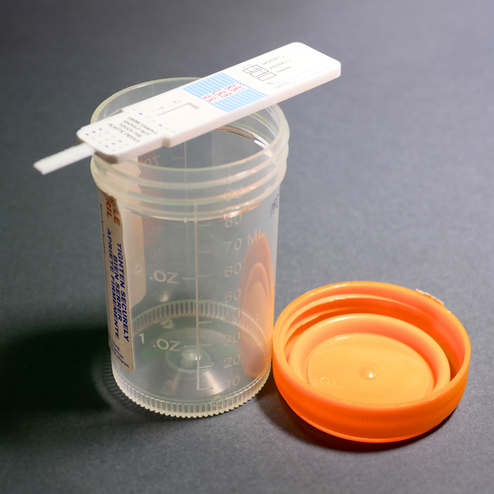 Substance use testing equipment.